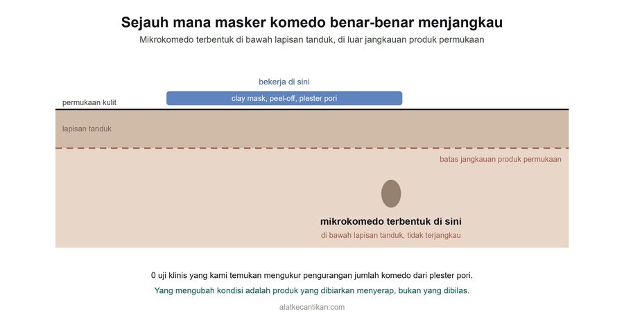 Diagram potongan kulit: clay mask, peel-off dan plester pori bekerja di permukaan, sementara mikrokomedo terbentuk di bawah lapisan tanduk di luar jangkauan produk permukaan